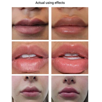 Ultra Hydrating Lip Care Essensen Fugtgivende Forbedrer Elasticitet Læber